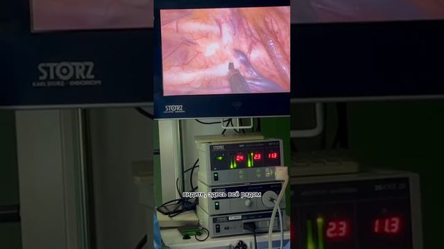 Как проходит симпатэктомия? смотреть онлайн