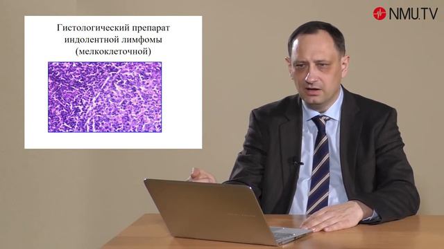 Відеолекція ЛЕЙКЕМІЇ ТА ЛІМФОМИ. Кліменко С.В. смотреть онлайн