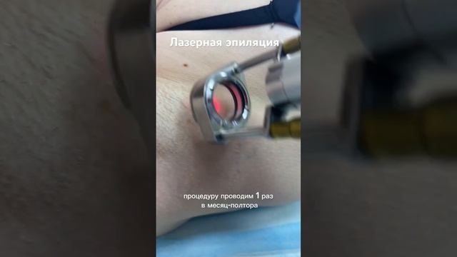 Лазерная эпиляция Александритовый лазером? смотреть онлайн