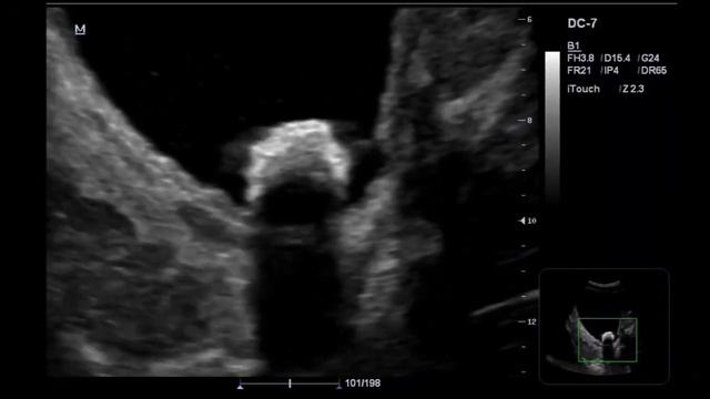 САНГИ ПЕШОБДОН смотреть онлайн