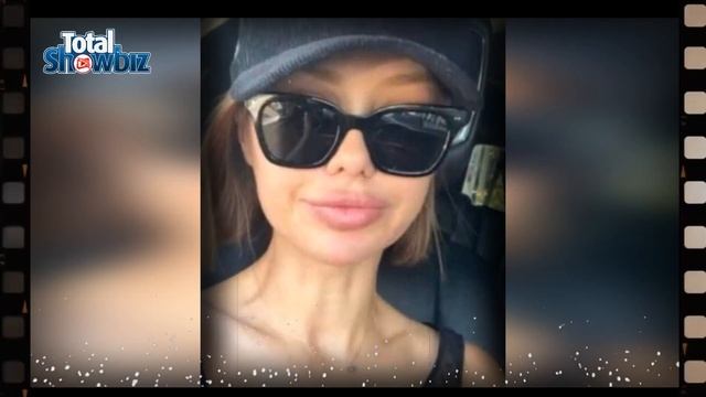 Виктория Боня случайно засветила свое новое лицо смотреть онлайн