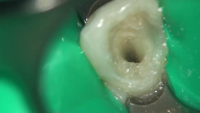 Кипячение смотреть онлайн