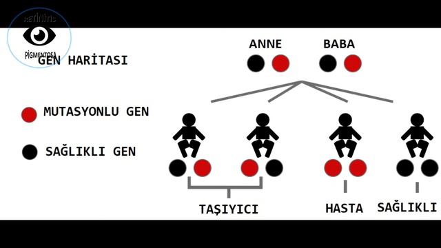Usher Sendromu Nedir? смотреть онлайн
