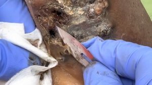 Willington’s jiggers and scales and rot - see full video and 100s others @riseupsociety.net