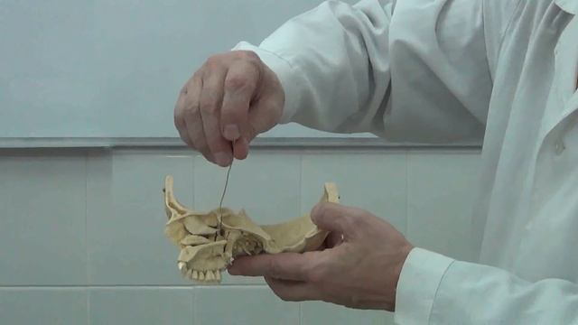 Небная кость