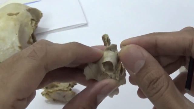 ETHMOID BONE смотреть онлайн