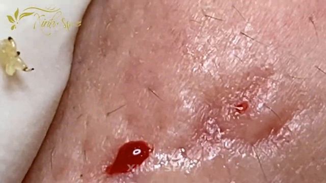 Let's Start A Beautiful Day With Xinh Spa 15 #01 смотреть онлайн