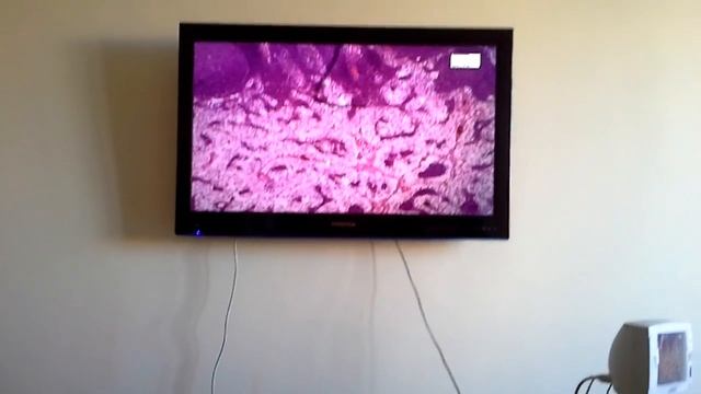 Гистология Тимус, Лимфоузел, Селезенка смотреть онлайн
