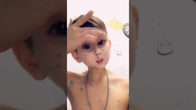 Вот что значит ветрянка смотреть онлайн