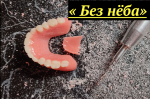 Съёмные БЕЗ нёба существуют_ #стоматология #протезированиезубов