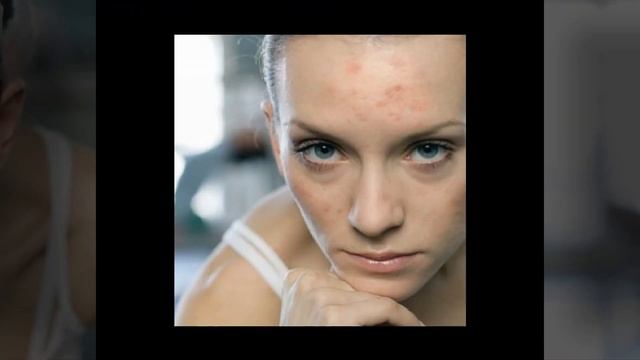 Косметика для жирной кожи: как выбрать смотреть онлайн