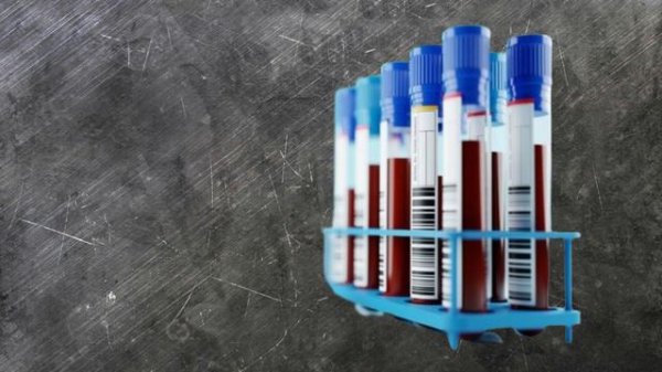 Tushda Qon Ko'rish Tabiri