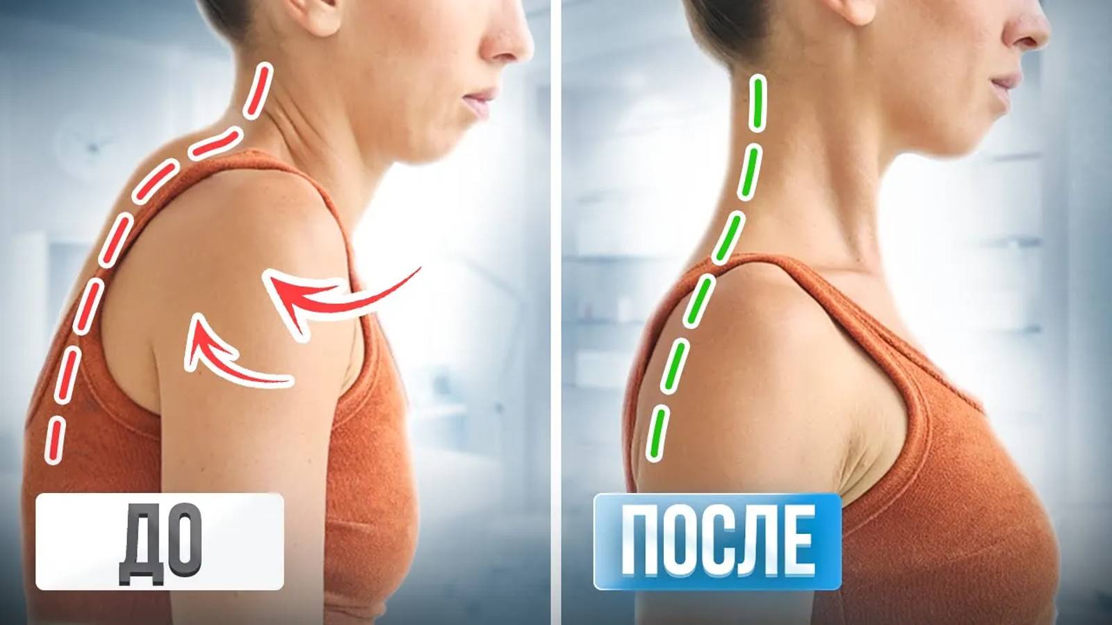 Упражнения от ХОЛКИ и СУТУЛОСТИ | Простой комплекс для осанки и здоровой спины на 20 МИНУТ смотреть онлайн