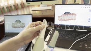 Отзыв владельца интраорального сканера Runyes после 3ех месяцев эксплуатации