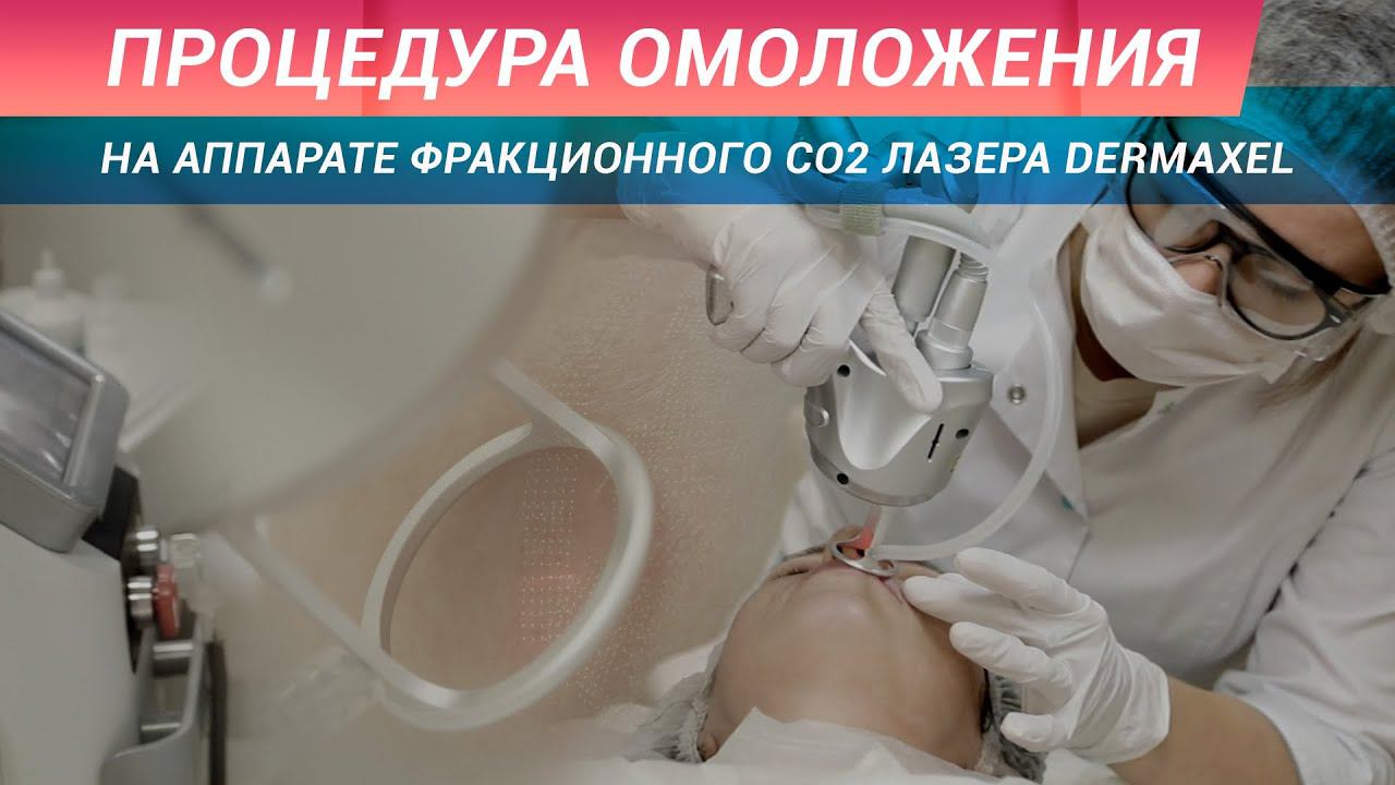 Лазерная шлифовка на аппарате DERMAXEL - реальный эффект омоложения у 100% пациентов смотреть онлайн