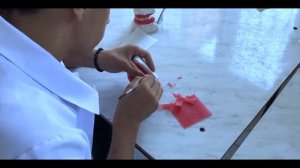 Лабораторные этапы изготовления частично съемного протеза. ЧАСТЬ 1