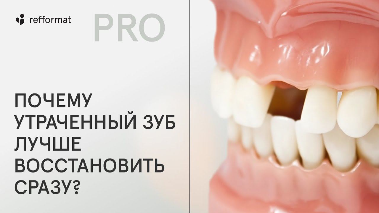 Почему утраченный зуб лучше восстановить сразу? смотреть онлайн