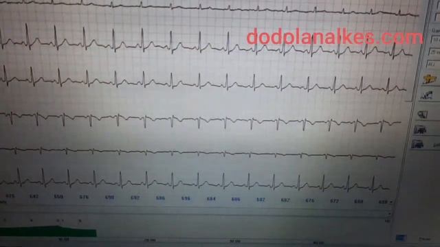CONTEC 8000S Ecg Stress Test