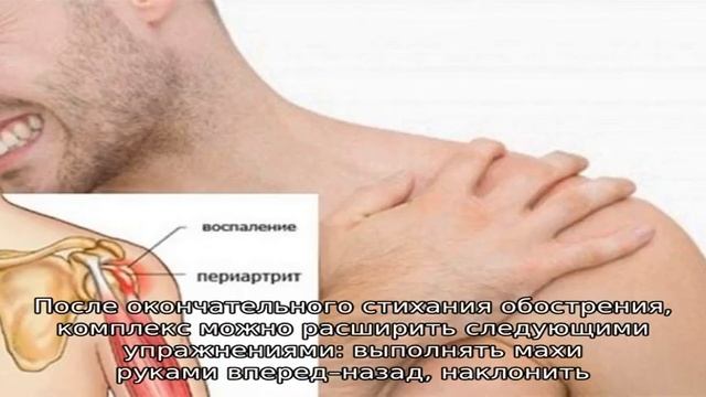 Лечебная гимнастика при плечелопаточном периартрите смотреть онлайн