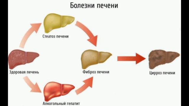 Как очистить печень. смотреть онлайн