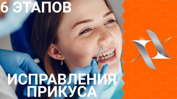 Брекеты: 6 этапов ортодонтического лечения.
