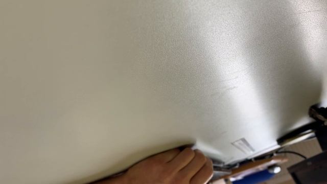 В Калининграде хирург прооперировал девочке здоровую руку смотреть онлайн