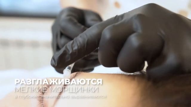 Косметология в Алматы. Устранение морщин диспортом.