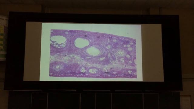 Лекция В.В. Глинкиной. Разбор препаратов, разбор схем к 4 коллоквиуму. Частная гистология смотреть онлайн