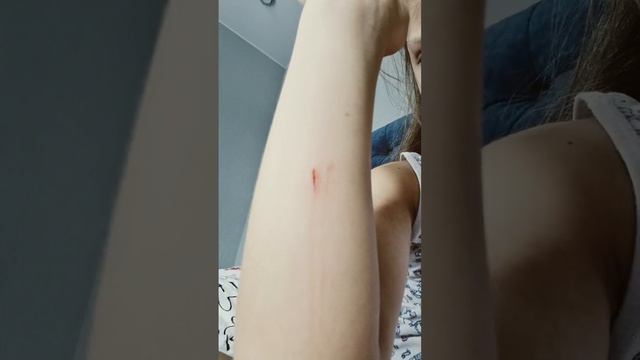 у меня порвалась рука 😭😭мне больно 🤕🤕🤕🤕 смотреть онлайн