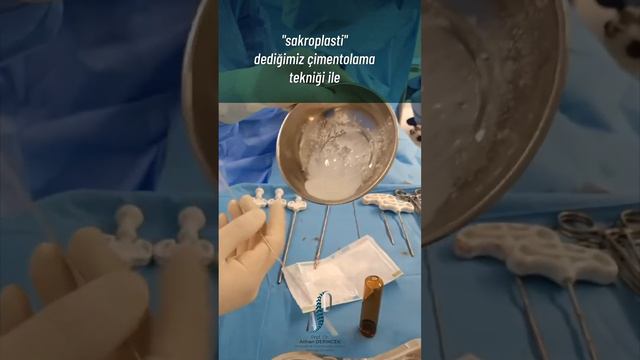 SAKROPLASTİ, SACROPLASTY смотреть онлайн