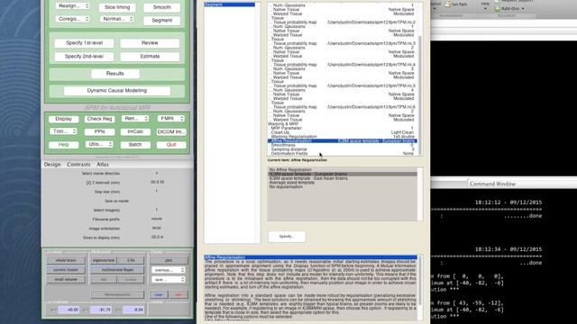 SPM Tutorial 12 - Image Segmentation смотреть онлайн