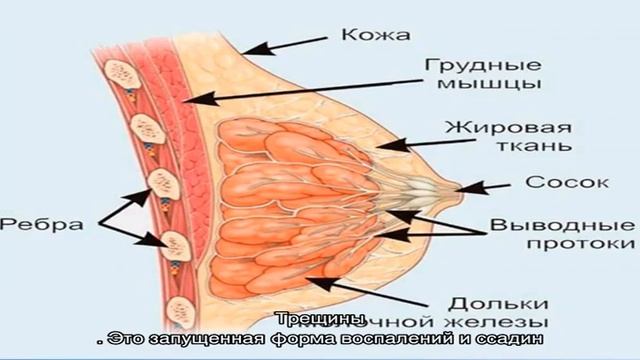 Почему болят соски и как с этим бороться? смотреть онлайн
