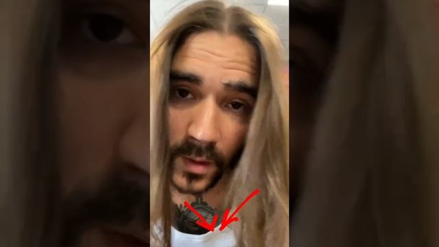 Юра Музыченко обратился к поклонникам смотреть онлайн