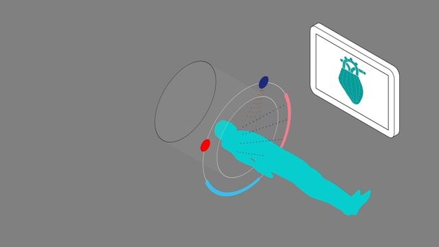 What is Computed Tomography (CT) and how does it work? смотреть онлайн