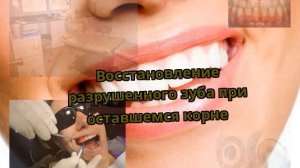 Восстановление разрушенного зуба при оставшемся корне
