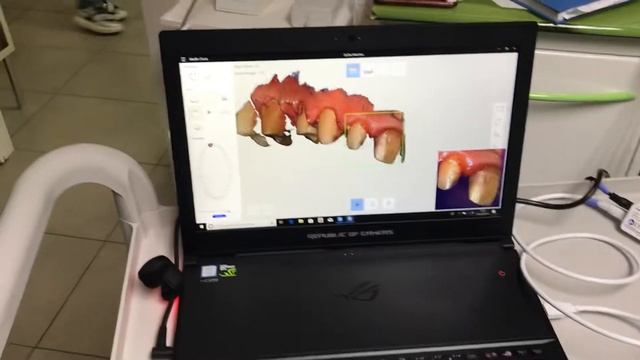 Scanner impronta intraorale Medit i500 смотреть онлайн