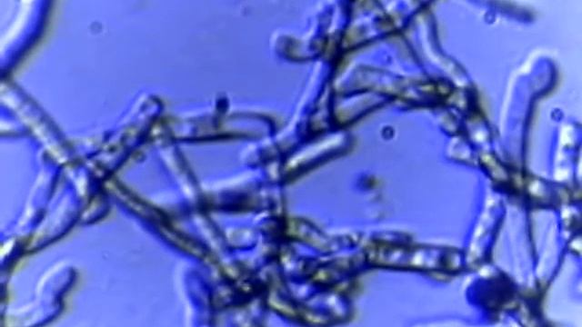 Плесень после ферментации борща. смотреть онлайн