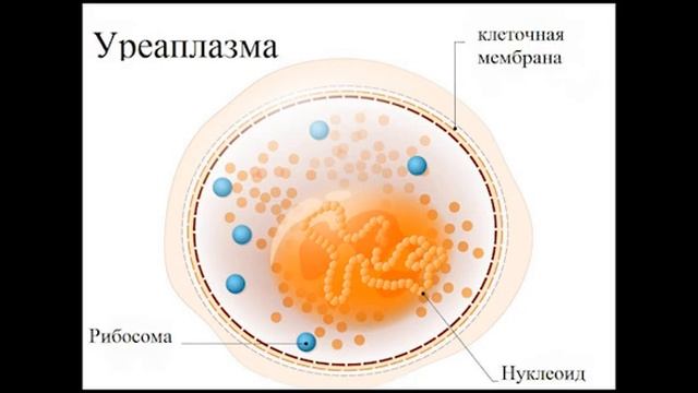 Уреаплазма смотреть онлайн