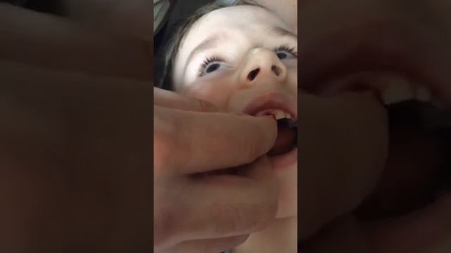 Вырывали зуб дома)) Держался до конца)) Молодец)) смотреть онлайн