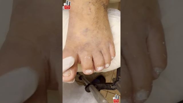 Nail Restoration ? Discomfort Nails #15 смотреть онлайн