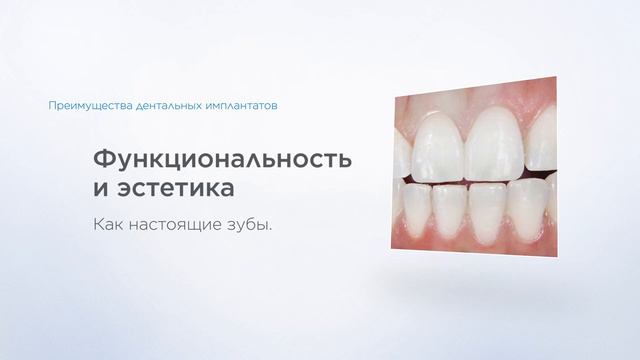 Стоматология "Сити Смайл". Dentsply Sirona. What is a dental implant film смотреть онлайн