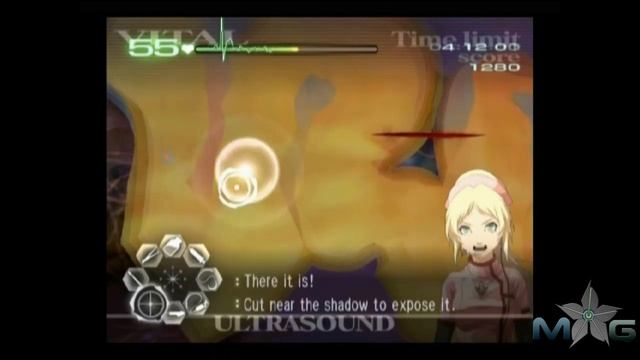 Trauma Center: Second Opinion Walkthrough - Episode 3-2: GUILT смотреть онлайн