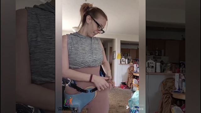 The beautiful woman has an amputated leg due to cancer and lives with an artificial leg смотреть онлайн