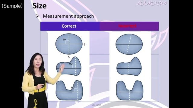초음파교육_Lymph node : Overview of LNs Sample 강의 샘플영상_SONOUS 대표강사 : 장경미 смотреть онлайн