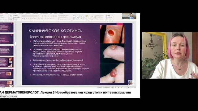 Обучение ОНЛАЙН специалиста по педикюру, подолога! Уникальный проект с командой врачей!