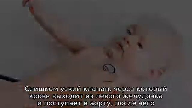 Врожденный порок сердца смотреть онлайн