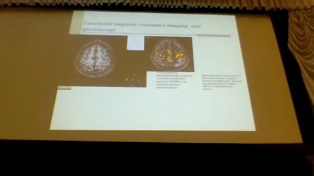 С. Д. Варфоломеев. Молекулярные основы интеллекта. Кинетика химических реакций в мозге человека.