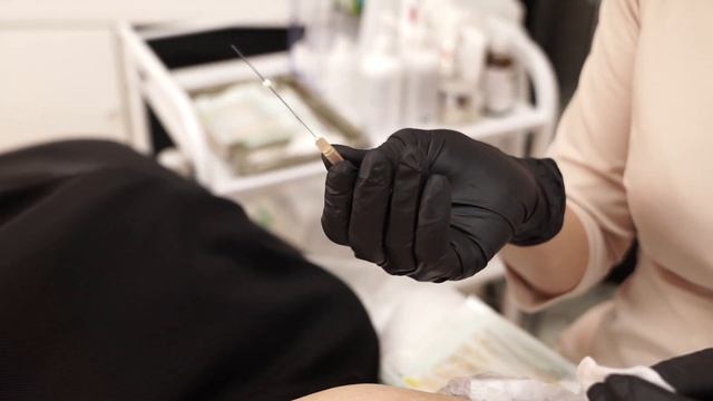 Армирование лица. Подтяжка мезонитями. Худое лицо. Фото до/после смотреть онлайн