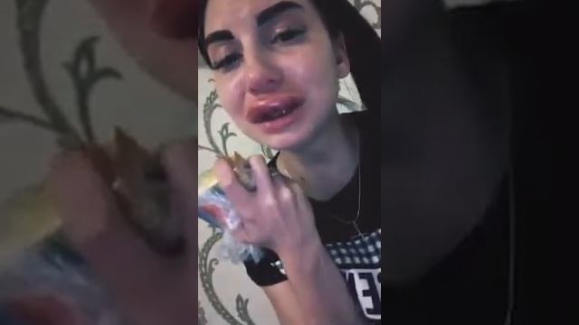 ВЕРХНЯЯ ГУБА ОПУХЛА И МОЖЕТ ВЗОРВАТЬСЯ? НЕУДАЧНОЕ УВЕЛИЧЕНИЕ ГУБ смотреть онлайн