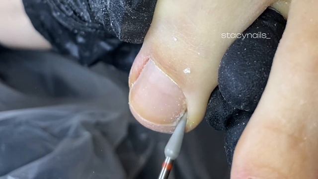 ОЧЕНЬ СУХАЯ КОЖА/ПЕДИКЮР/ ПОДНОГТЕВЫЕ МОЗОЛИ смотреть онлайн